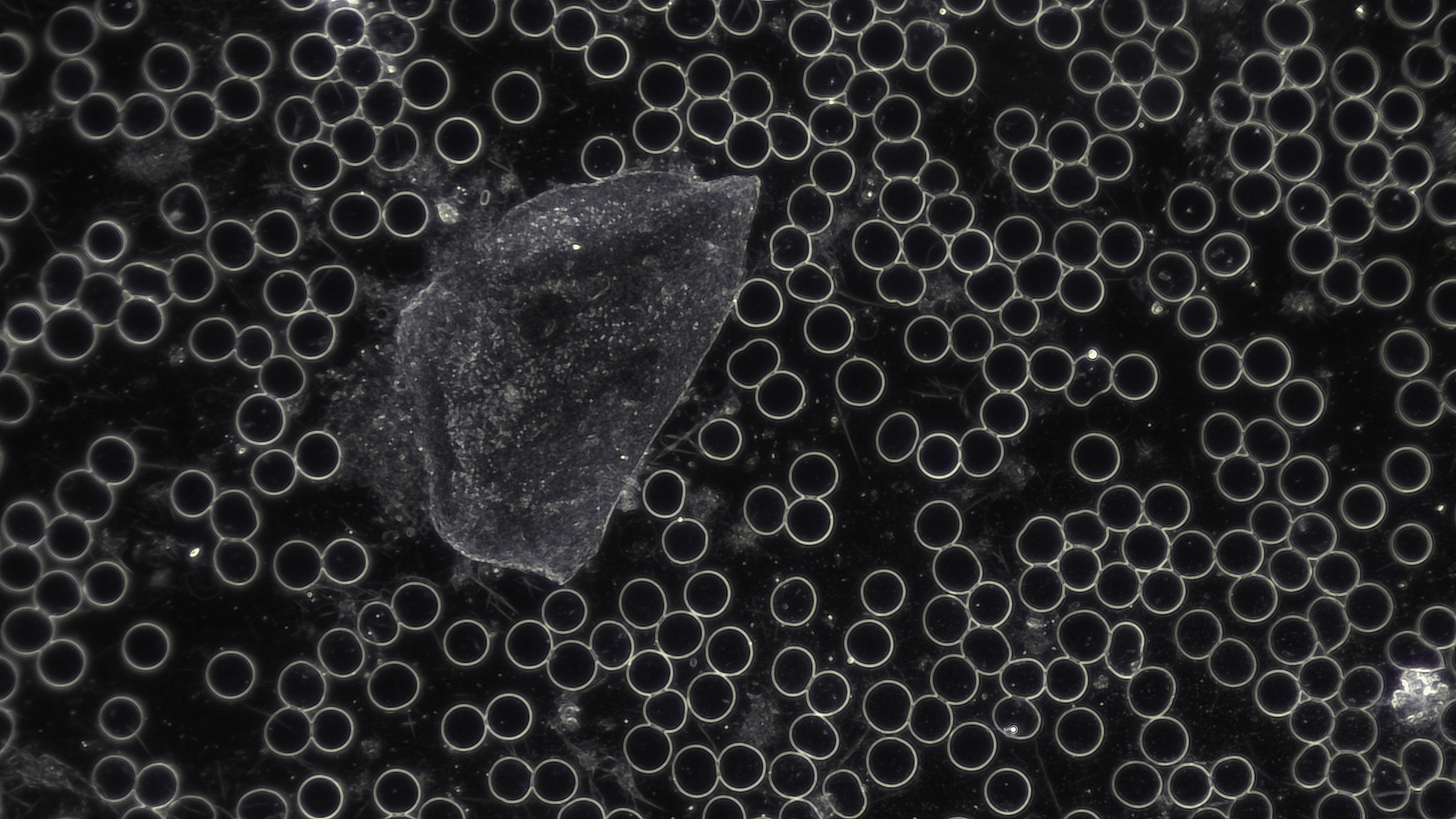 HDC DF5 Sample Recording in Darkfield