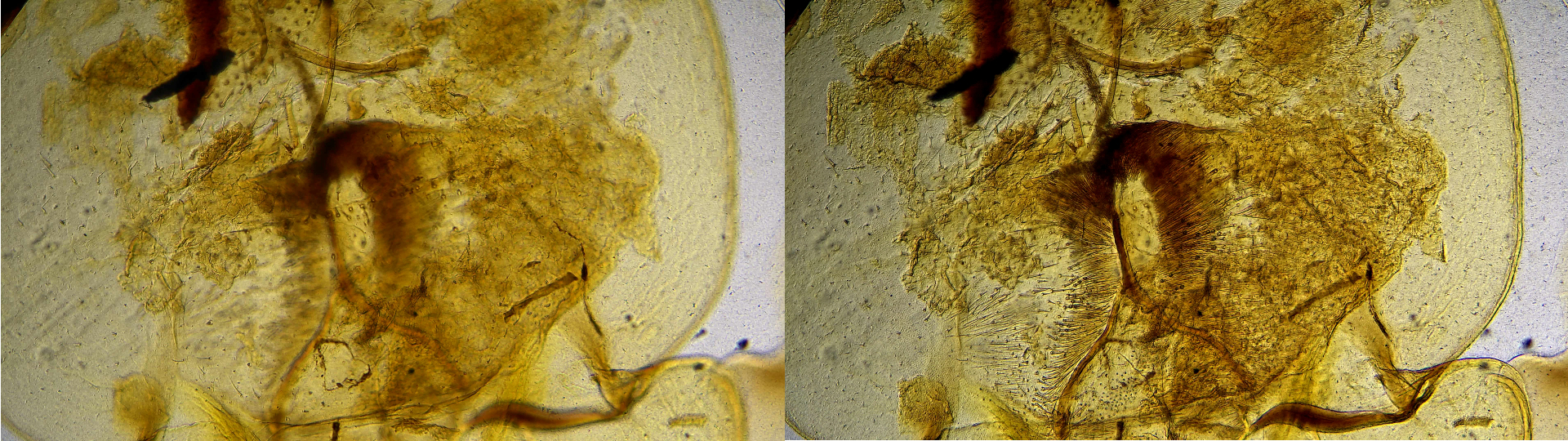 EDOF function of the HDC DF4 microscope camera