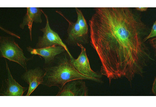 Tucsen Truechrome fluorescence sample